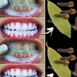 STOP EATING! These 6 Dangerous Foods that Increase Proteinuria and Destroy Your Kidneys