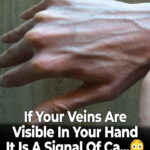 Papaya Sap for Cracked Heels: A Simple Natural Remedy