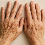 The most powerful fat-burning drink (5.5 kg in 3 days)