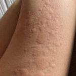 BEWARE, THIS IS HOW DIABETES BEGINS. You can have it without knowing it!! These are the 8 signs you have too much blood sugar.