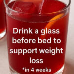 Spots on the Hands: Are They The Signs of Melanoma – The Most Dan.gerous Form Of Skin Can.cer?