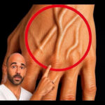 Early Menopause: 10 Signs (and More) to Watch Out For