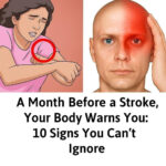 Bay Leaf Is 100,000 Times Stronger Than Botox? | Natural Wrinkle Eraser Even at Age 70!