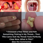 The Secret of a 97-Year-Old Orthopedic Doctor: The Natural Food That Regenerates Your Joints in 24 Hours