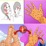 7 Critical Signs Your Kidneys Are in Danger: Don’t Ignore These Warning Signals