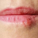 What Chin Whiskers Might Tell You About Your Health