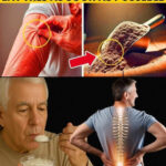 10 Subtle Stroke Symptoms in Women That Could Save Your Life If Spotted Early