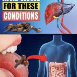 6 foods to avoid if you suffer from fatty liver disease and 5 best foods for fatty liver disease