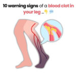 Maggots in the Trash Bin? Here’s How to Prevent Them