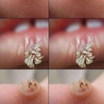 Here’s a simple method for getting rid of bleach stains on clothing. Proceed with the initial remark