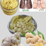 8 Signs You Have Too Much Sugar in Your Body (And What to Do About It)