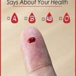 I pulled out shoes I haven’t worn all winter and found white fuzzy patches growing on the leather. What is this?