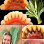 Are Your Nails Always Splitting or Breaking? Here’s What Your Body Might Be Trying to Tell You