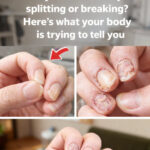 Cinnamon and Honey: The Powerful Natural Remedy That Still Amazes Modern Medicine